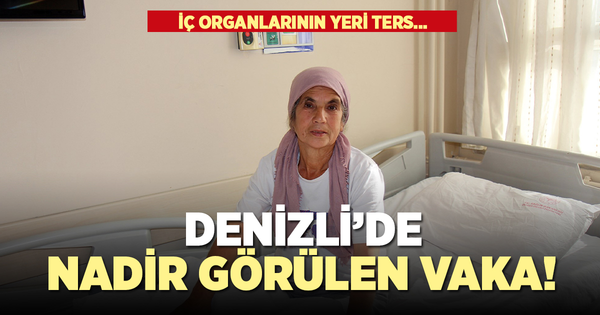İç organları ters olan hasta sağlığına kavuştu!