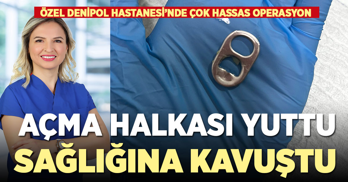 Açma halkasını yutan küçük kız, Denipol’de yapılan başarılı operasyonla sağlığına kavuştu