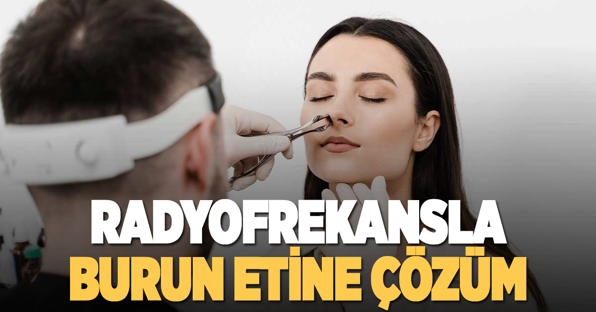 Burun eti sorununa radyo frekansla etkili çözüm