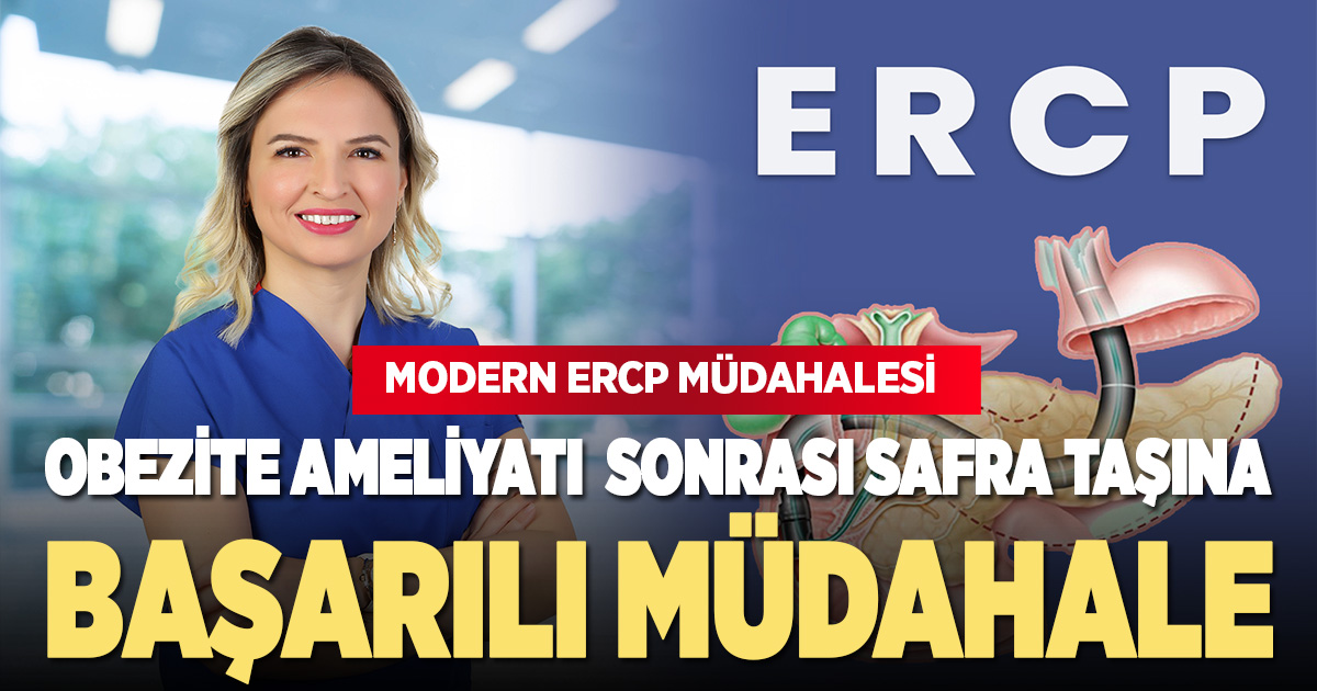 Obezite Ameliyatı Olmuş Hastanın Safra Taşlarına ERCP ile Başarılı Müdahale