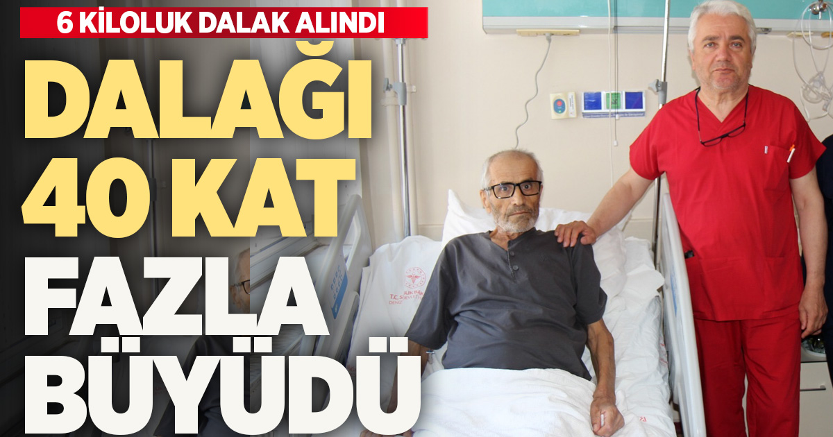 DALAĞI NORMALİN 40 KATI BÜYÜYEN HASTA, AMELİYATLA SAĞLIĞINA KAVUŞTU
