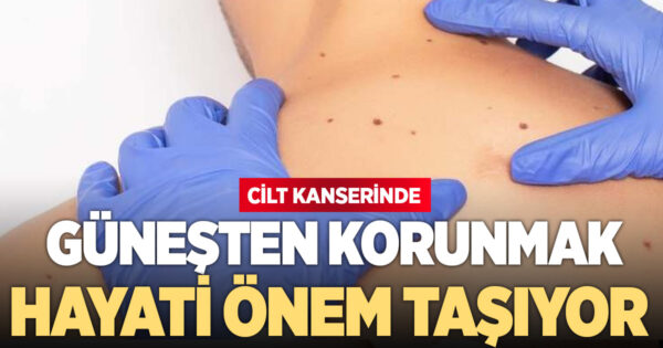 Cilt kanserine karşı güneşten korunmak önem taşıyor