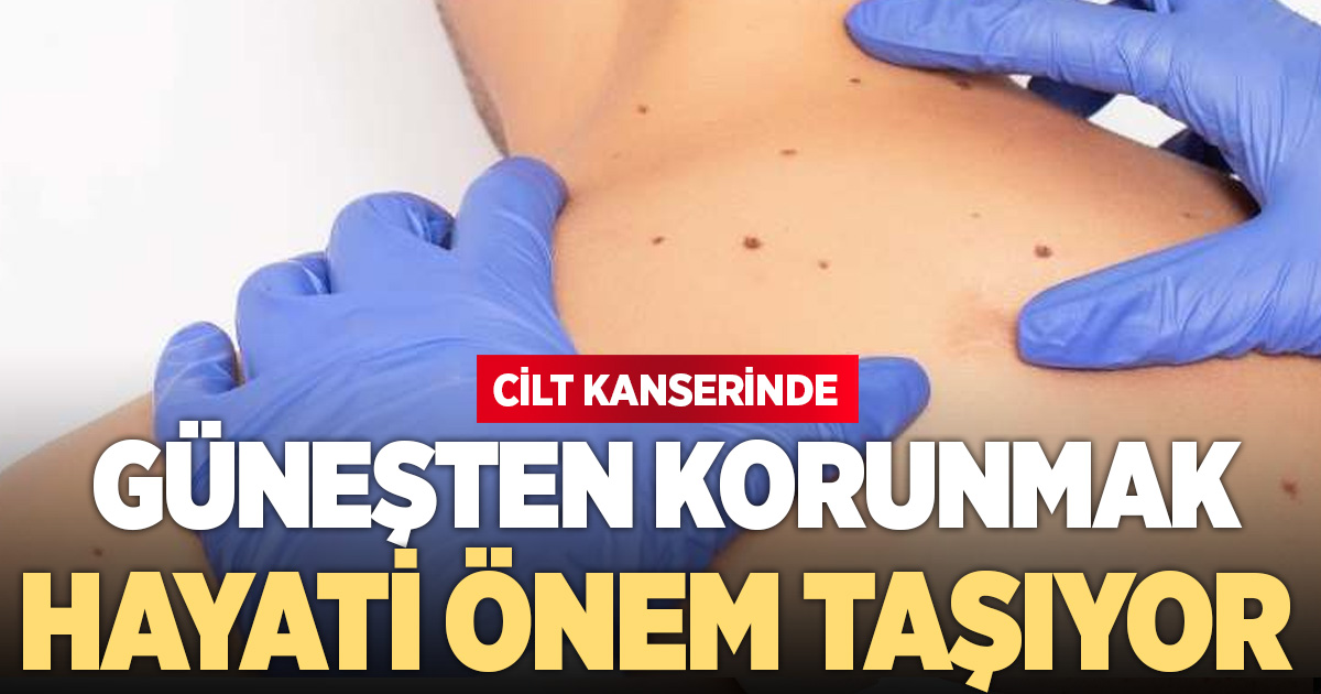 Cilt kanserine karşı güneşten korunmak önem taşıyor
